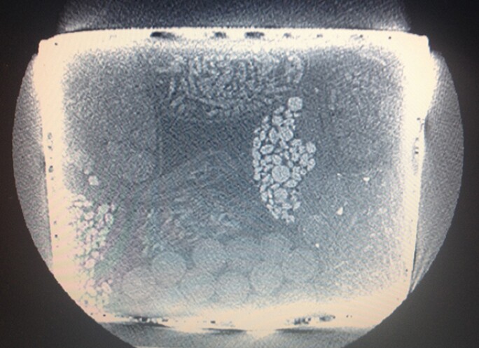 x-ray-of-bronze-interior.jpg