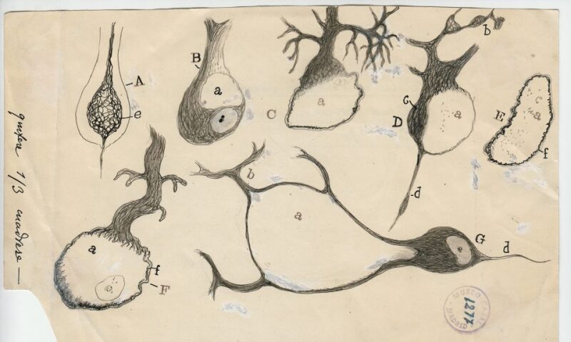 Injured Purkinje neurons of the cerebellum